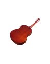 CORDOBA ITALIA CP100 GUITAR PACK